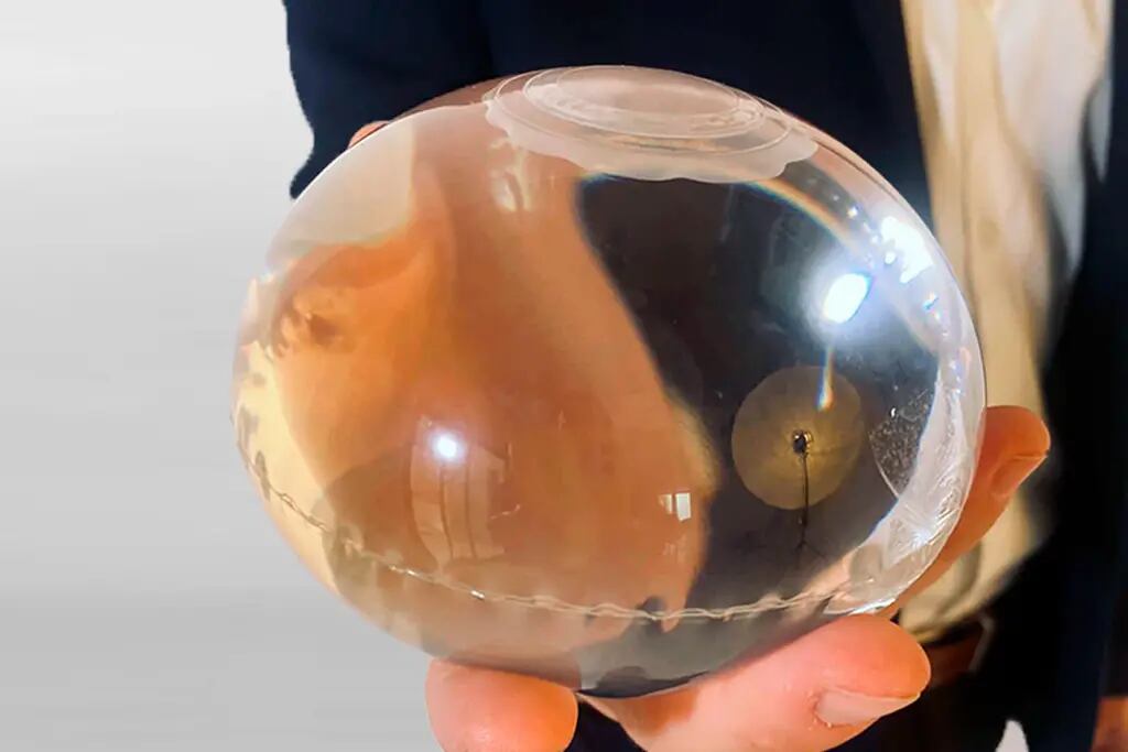 Balón Gástrico: La nueva invención para bajar de peso